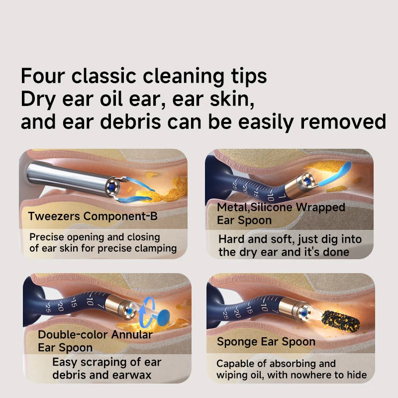 2025 Xiao'm Bebird EarSight Plus I35R Visual Ear Cleaner HD Clipable Tweezers Earpick Wireless Cleaning Endoscope with Camera